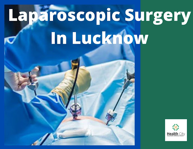 Laparoscopic surgery in lucknow
