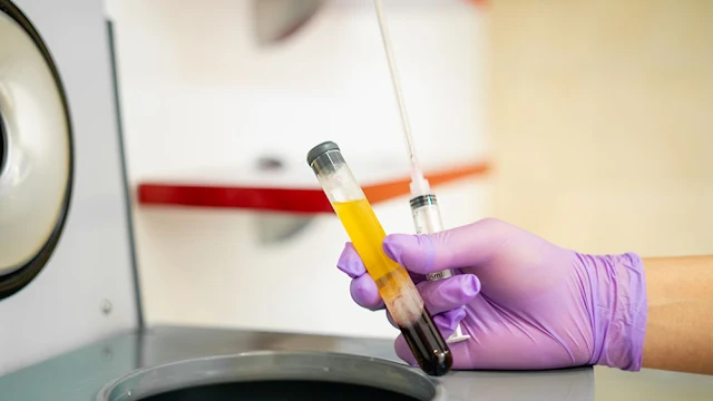 Antibodi Dari Mantan Pasien COVID-19 Bisa Menjadi Obat Virus Corona