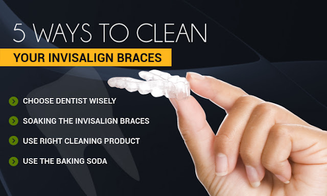 5 ways to Clean your Invisalign Braces