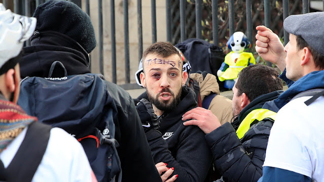 Joven 'chaleco amarillo' que perderá un ojo por la violencia policial: "No reconozco a mi país"
