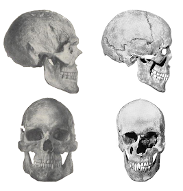 Comparison of a robust skull and a comparatively gracile skull.