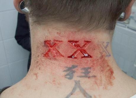 Triple X Scar Tattoo