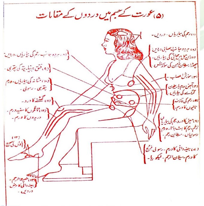 Places of pain in a woman's body.