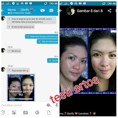 Testimoni Ertos Facial Wash Brightening