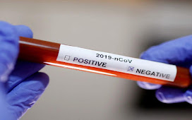 Vacina cearense contra Covid-19 pede autorização da Anvisa para iniciar testes em humanos