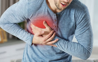 Mitos Serangan Jantung Saat Berolahraga: Penjelasan dari Dokter Spesialis. (Gambar ilustrasi)