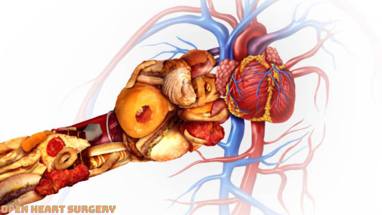 3 Top Tips  Open Heart Surgery  A Patient's Perspective