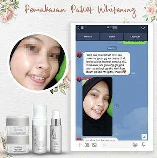 NYATA HASILNYA, Ms Glow Cushion, Ms Glow Collagen, Ms Glow Cream Siang Malam, Ms Glow Day Cream, Ms Glow Distributor,   Order..??   SW Grosir Kosmetik  ADMIN 1 : WA +62 858 7627 8213 Atau klik http://bit.ly/OrderGrosirKosmetik  ADMIN 2 : WA +62 821 4361 1481 Atau klik http://bit.ly/Supplierkosmetikku   Isi Format Order Agar Cepat Di Proses :  Nama : Alamat :  No. HP :  Orderan dan Jumlahnya :  Transfer Sebelum jam 3 Sore DIPROSES Pada Hari yang Sama, Diatas jam 3 Dikirim Besok nya ya, Terimakasih :)  #MsGlowDokterKecantikan, #MsGlowDetox, #MsGlowDarkspot, #MsGlowDiet, #MsGlowDenpasar, #MsGlowEyeCream, #MsGlowEceran, #MsGlowEmas, #MsGlowFemaleDaily, #MsGlowFlekForte,