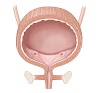 Bladder infection is also known as (cystitis), Causes of Bladder Infections, 