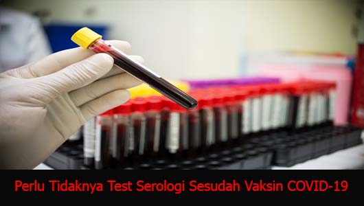 Perlu Tidaknya Test Serologi Sesudah Vaksin COVID-19