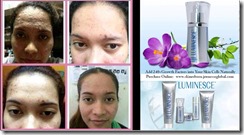 8_Serous Acne testimonial-1[4]