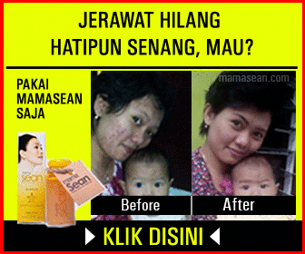 Hilangkan jerawat dengan mamasean
