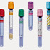 Key fixtures that you need to know about blood collection tubes