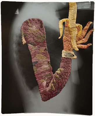 Cool And Creative Embroidered X-Rays Art Pictures by Matthew Cox Seen On www.coolpicturegallery.us