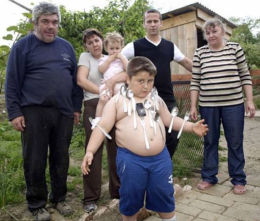 Tubuh Anak Ini Ivan Stoiljkovic Bermagnet, Dapat Menempel Benda Logam ke Tubuhnya Sampai 25 kg dan dapat menyembuhkan penyakit - the facemash post