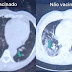 COVID: Imagens de exames mostram diferenças nos pulmões de vacinados e não vacinados