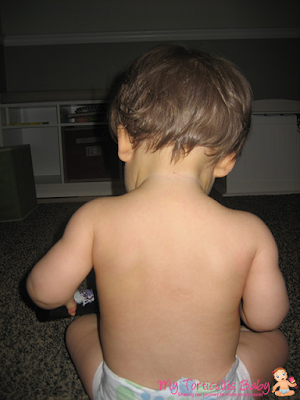 Baby with slight right torticollis looking down at the ground