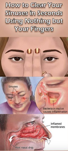 How to get rid of blocked sinuses in seconds.