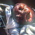 OMG,This Is Worse! Another Deadly Virus Surfaces- Marburg Haemorrhagic Fever (Graphic Photo)