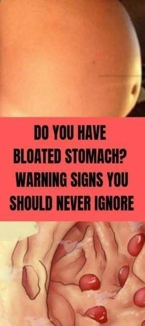 Do You Have Bloated Stomach? Warning Signs You Should Never Ignore
