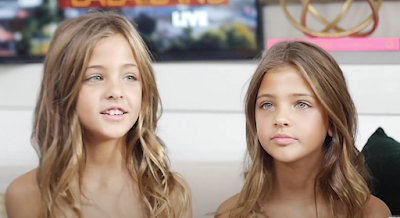 This Is What The World’s Most Beautiful Twins Look Like Today