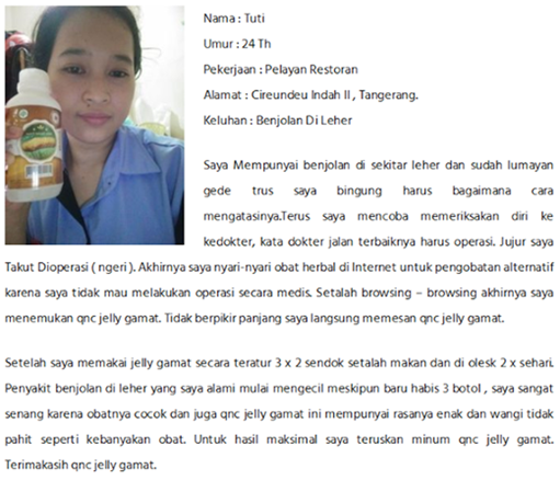 Obat Gondok Pada Wanita