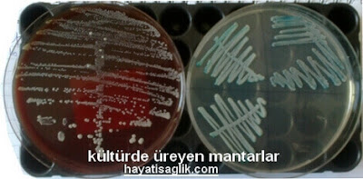 mantar kültüründe üreyen bakteriler