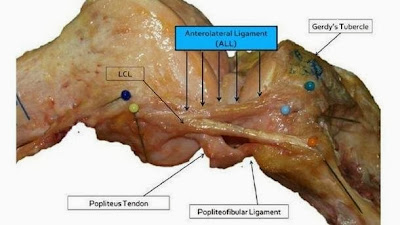 BieneSaludAlgoM Ligamento