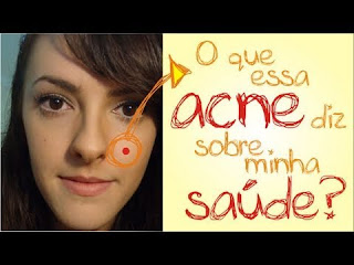 cara como tirar, tirar espinhas rapido facil, como tirar espinhas da cara em 1 dia, tirar espinhas do rosto naturalmente, acabar espinhas em 3 dias, tirar espinhas do rosto caseiro, como tirar espinha do rosto de homem, eliminar espinhas em 1 dia, como tirar espinhas da testa