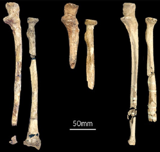 6,000-yr-old skeletons in French pit were victims of violence