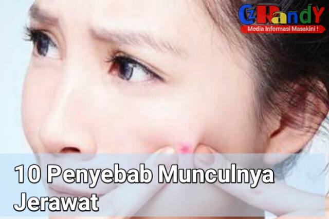 10 Penyebab Munculnya Jerawat Pada Wajah