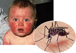 zika virus