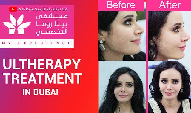 Ultherapy Treatment in Bella Roma Dubai