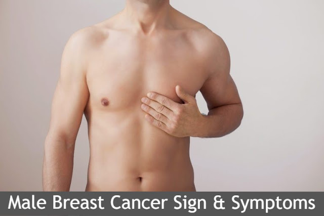 Male Breast Cancer Sign and Symptoms