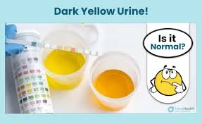 What is Urine infection ?  What are the causes and symptoms of urine infection ? How to prevent ? I Health Tips
