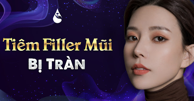 tiêm filler mũi có bị tràn không