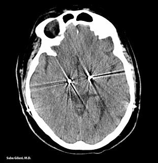 Brain Radiology5