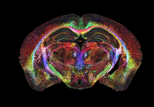 sección coronal del cerebro del ratón curiosciencia