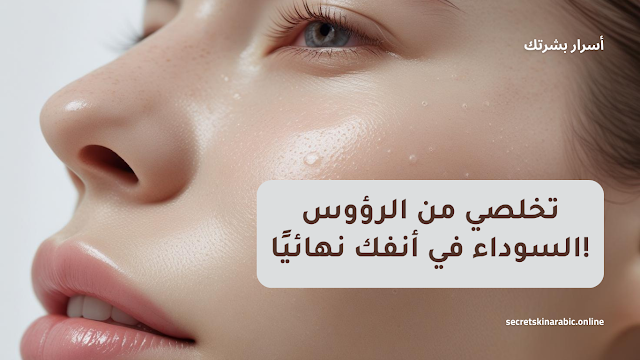 تخلصي من الرؤوس السوداء في أنفك نهائيًا! ماسكات طبيعية، بخار، ونصائح فعالة لبشرة نظيفة ومسام مغلقة