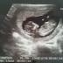 Week 12 Pregnancy Update