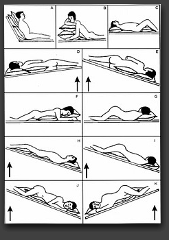 Prosedur Cara Postural Drainase dan Fisioterapi Dada 