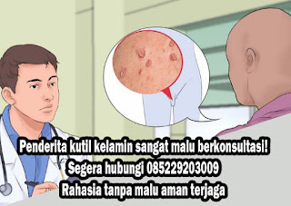 Obat Kutil Kelamin