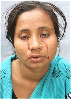 rashida khatoon crying blood miracle