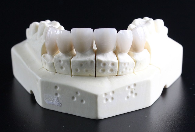 اعراض خراج الاسنان واهم اسبابه وعلاجه السهل