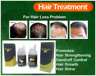 Best Natural Product for Hair loss Treatment