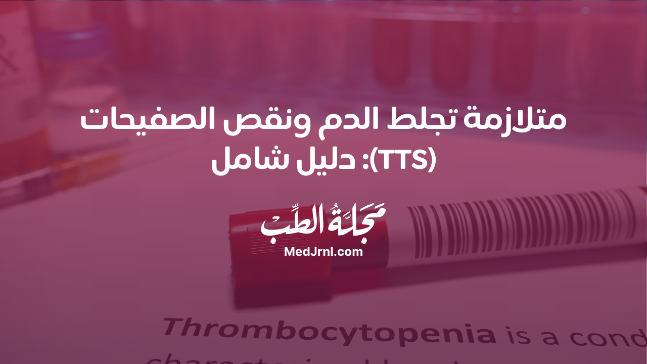 متلازمة تجلط الدم ونقص الصفيحات (TTS): دليل شامل