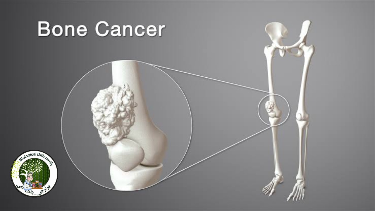 The Curse of cancer The Curse of cancer