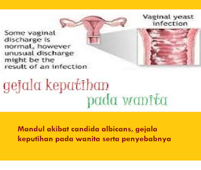 Mandul akibat candida albicans, gejala keputihan pada wanita serta penyebabnya