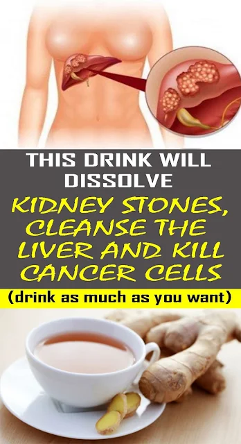 Ginger Tea: Dissolves Kidneys Stones, Kills Cancer Cells And Cleanses Liver – Recipe