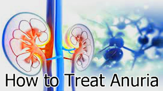 How to Treat Anuria